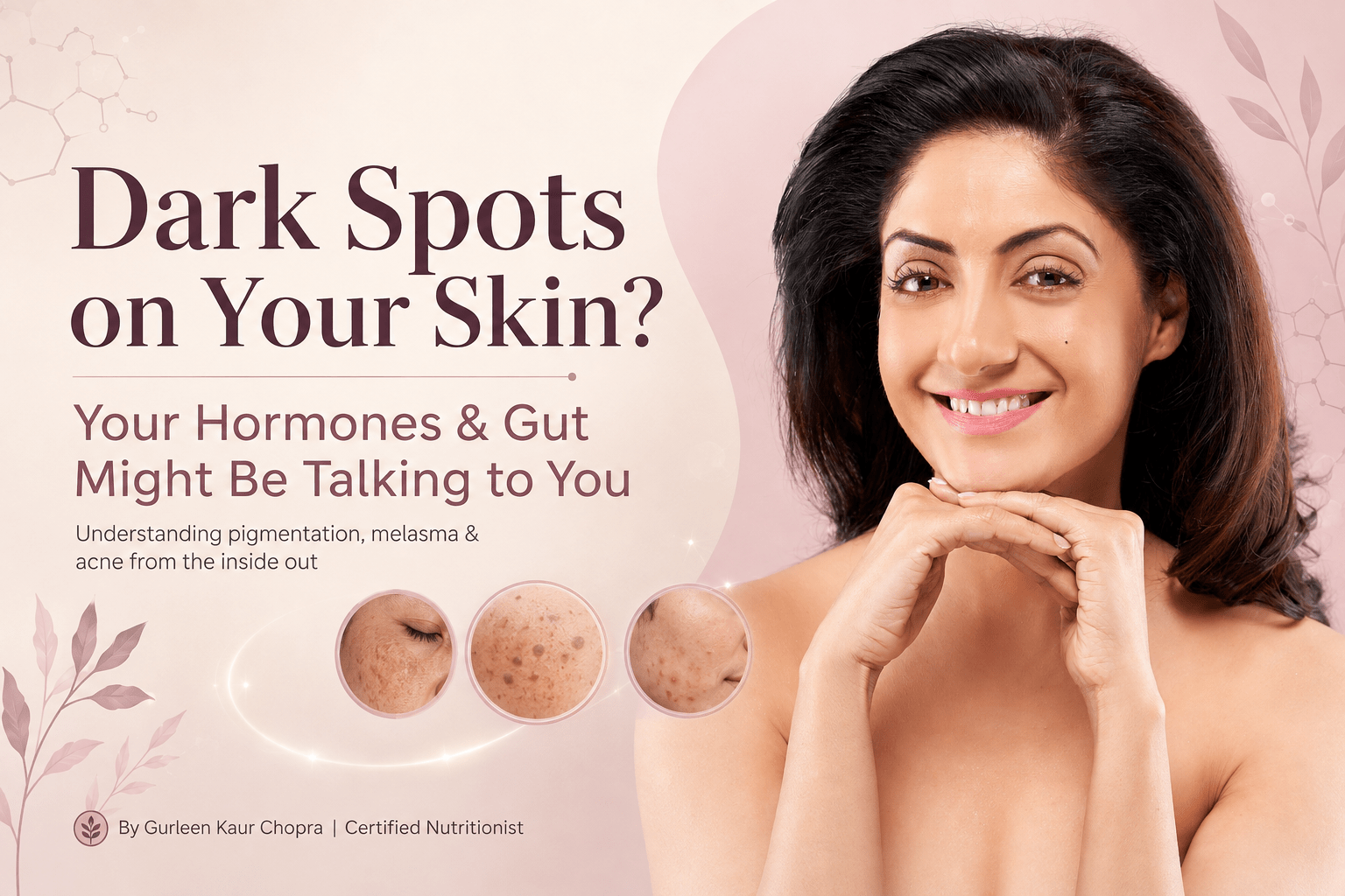 Dark spots on the skin? Your Hormones and Gut Might Be Talking to You