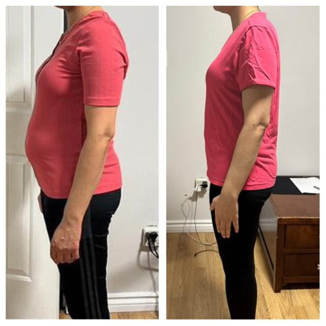 Side profile before and after weight loss transformation
