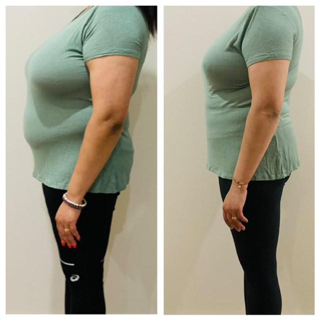 Side profile before and after weight loss transformation