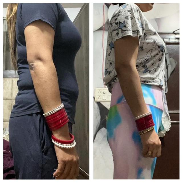 Side profile before and after arm and waist slimming