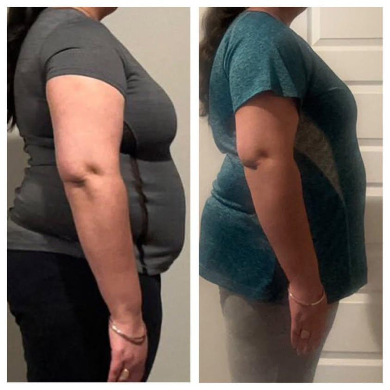Side profile before and after weight loss transformation