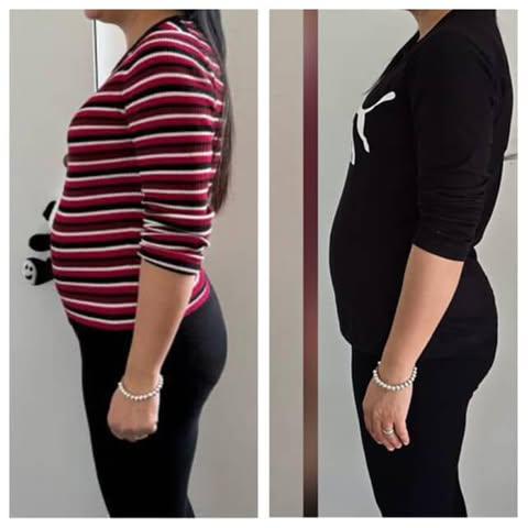 Side profile before and after transformation