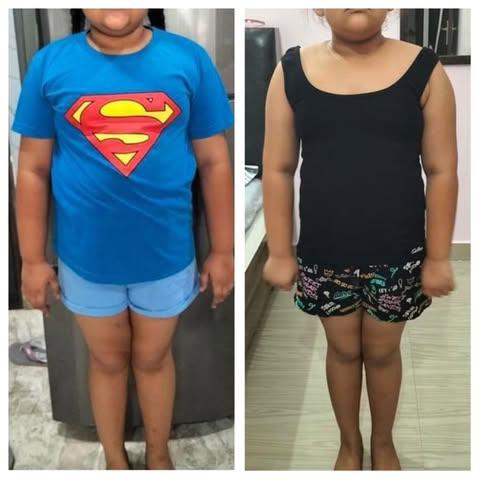 Front view before and after body transformation of a child client