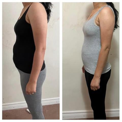 Side profile before and after weight loss transformation showing a reduced belly