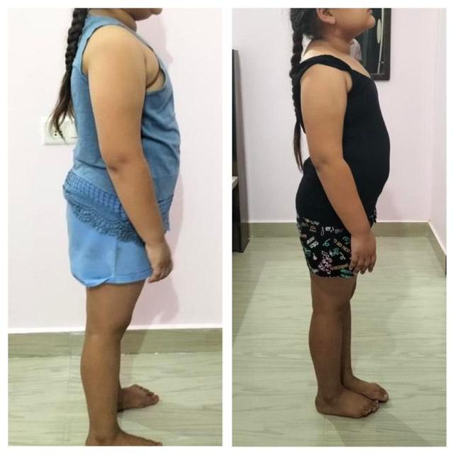 Side profile before and after body transformation of a young client
