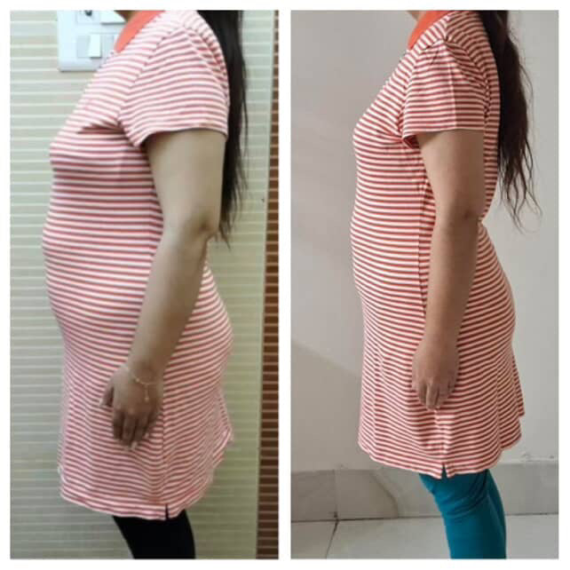 Before and after weight loss side profile transformation – GC Diet client result