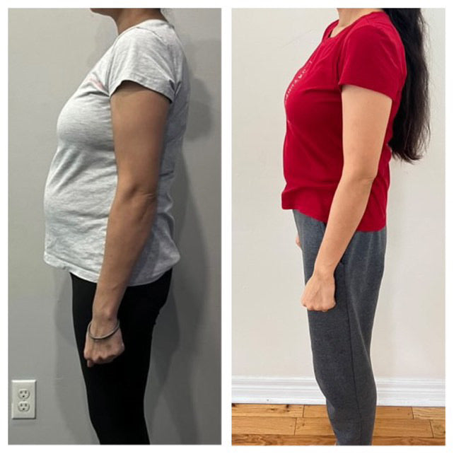 Before and after weight loss and posture improvement side profile – Gurleen Chopra wellness client