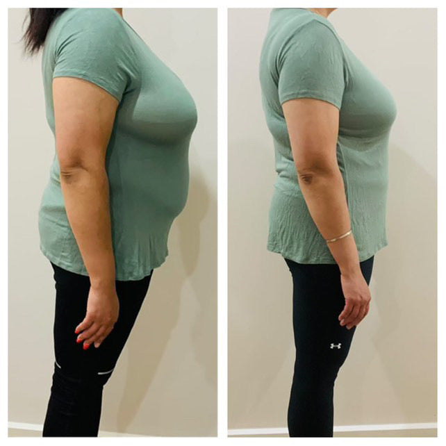 Before and after weight loss side profile transformation – GC Diet program client
