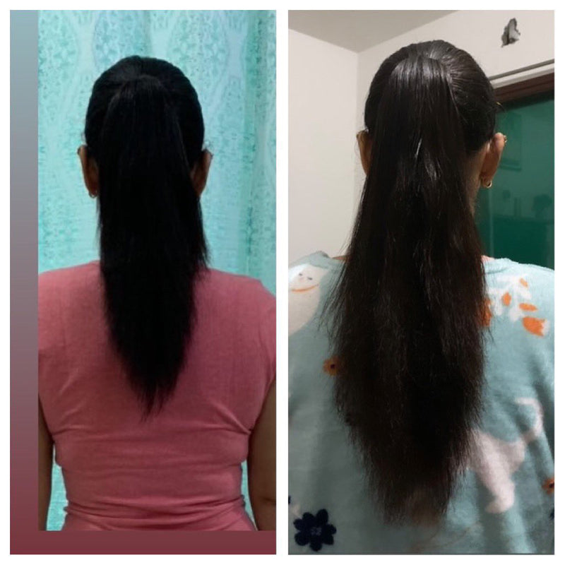 Before and after hair growth transformation back view – Gurleen Chopra nutrition counselling client result