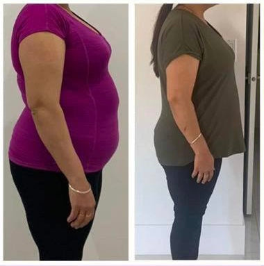 Before and after weight loss side profile – GC diet transformation client