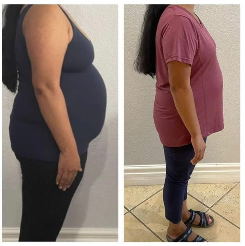 Before and after weight loss side profile transformation – GC Diet client result