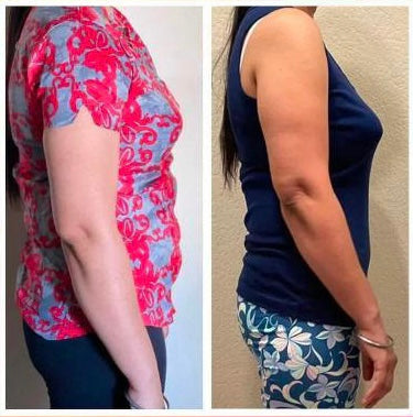 Before and after weight loss side profile – GC nutrition client result