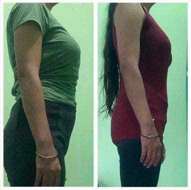 Before and after weight loss side profile – GC Diet transformation client