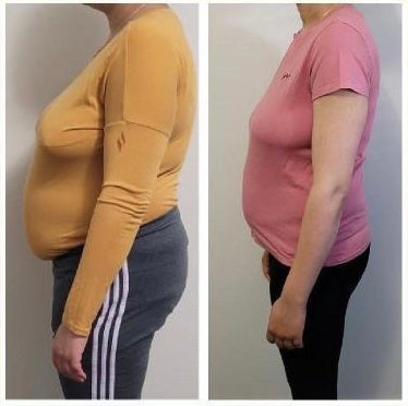 Before and after weight loss side profile – GC diet and wellness transformation client
