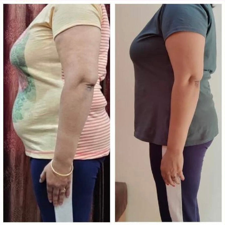 Before and after weight loss side profile transformation – GC Diet client result