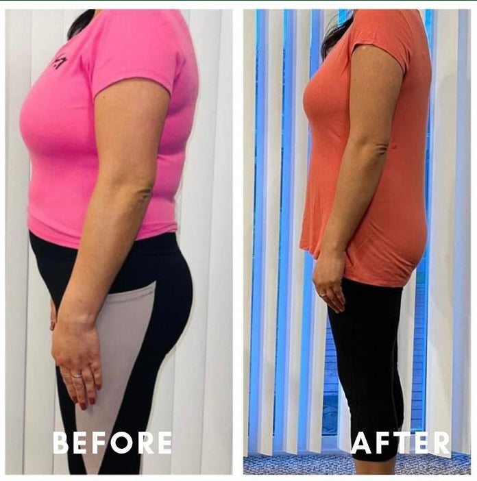 Before and after weight loss side profile transformation – GC diet and wellness client