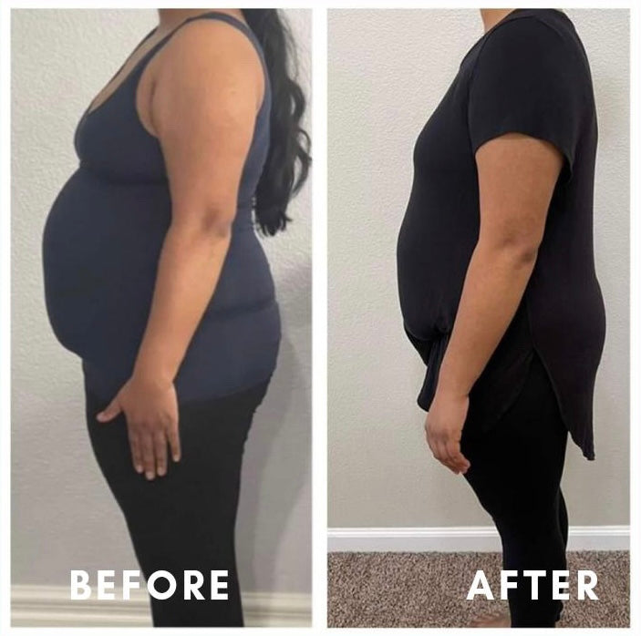 Before and after weight loss side profile – GC Diet and wellness client transformation