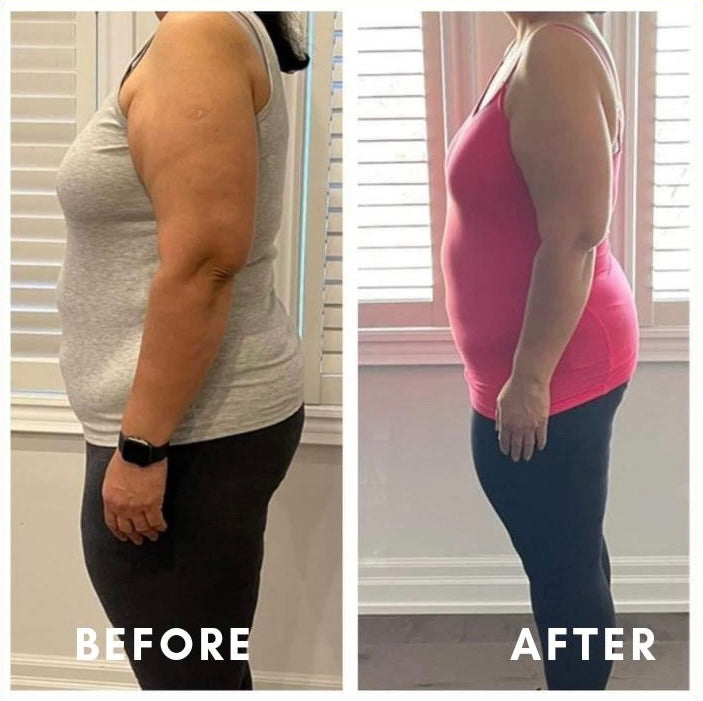 Before and after weight loss side profile – GC Diet client transformation