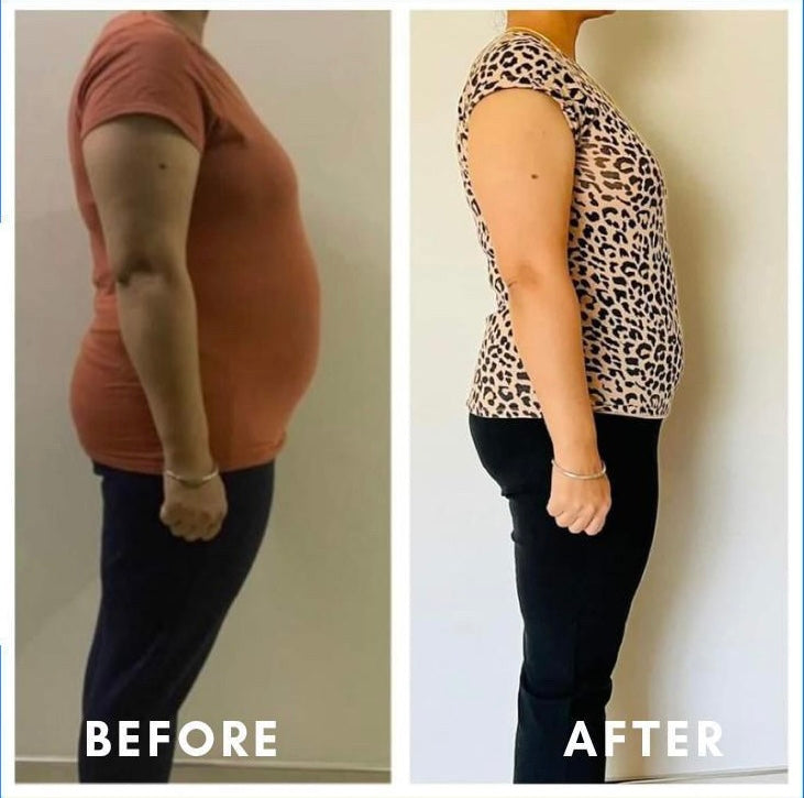 Before and after weight loss side profile – GC Diet client transformation