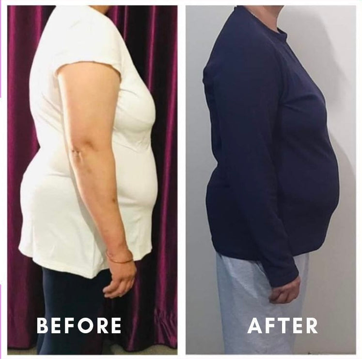 Before and after weight loss side profile – GC Diet transformation client